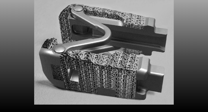 Spine Innovation’s LOGIC Interbody System Earns FDA Clearance